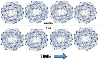 Critical and Ictal Phases in Simulated EEG Signals on a Small-World Network